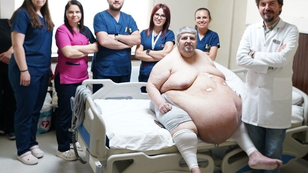 Nazillili vatandaş 310 kiloya ulaşmıştı: Ağır bedenine karşı açtığı savaşı kazandı